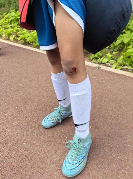 弗拉霍维奇小腿受伤 球员将错过多场联赛关键战