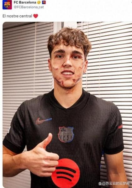 库巴西在欧冠两次染红 20岁前创下尴尬纪录